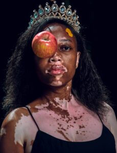 Dennis Otieno, Kenya