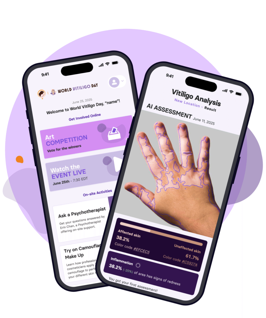 Skinopathy vitiligo app