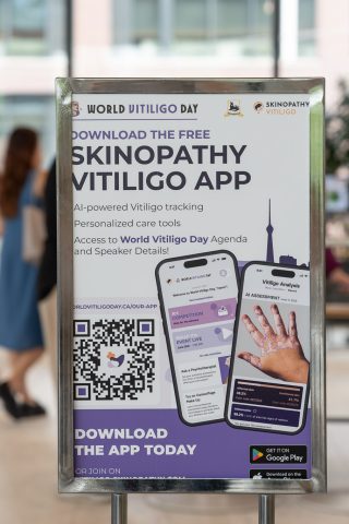 worldvitiligoday-320