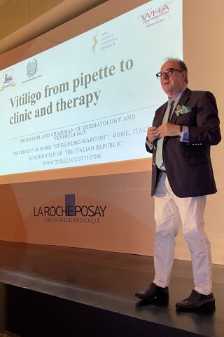 World Vitiligo Day 2022 celebrations in Mexico